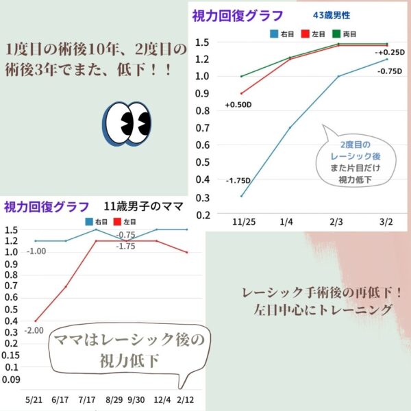 レーシック後視力回復グラフ2